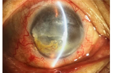 ��(d��)�������U(xi��n)׃�p��ʧ������(��i)��Ӣ���ۿ���B�����ڸ��y�����g(sh��)��ҕ��